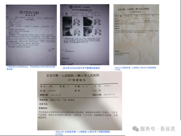 宫颈癌及肺癌术后随访CT报告——两肺未见新发病灶
