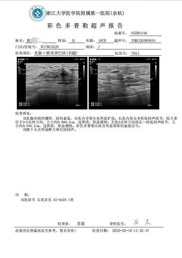 乳腺结节BI-RADS分级对比