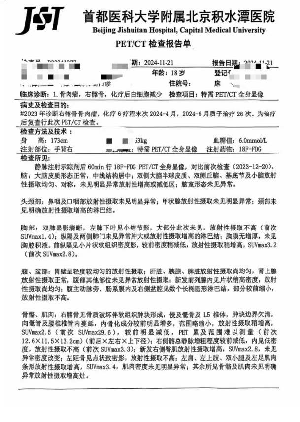治疗前后影像对比——肿块缩小