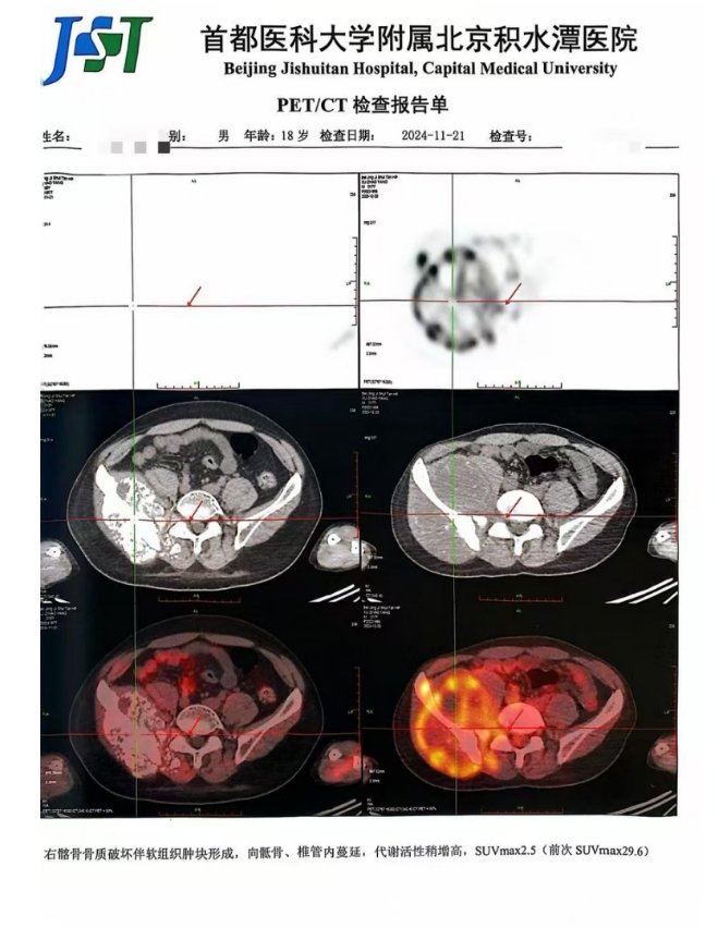 患者化疗与质子治疗记录