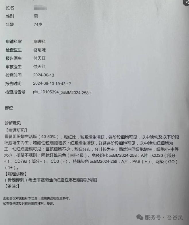 图1. 骨髓病理报告——非霍奇金B细胞性淋巴瘤累犯骨髓