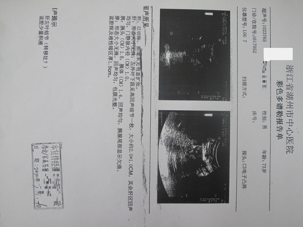 湖州市中心医院肿瘤标志物检查报告